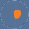 Bladder Scanner HD3 - Image 2
