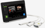 Portable Ultrasound Scanners for Diagnostic Imaging