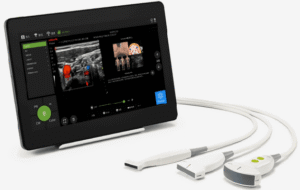 Portable Ultrasound Scanners for Diagnostic Imaging