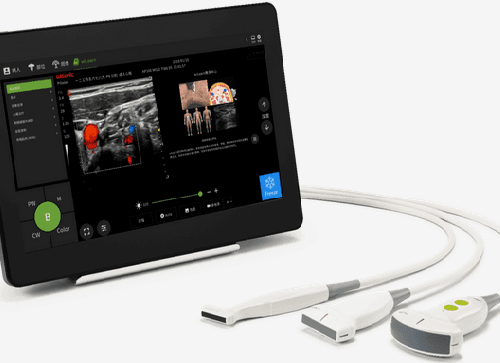 Portable Ultrasound Scanners for Diagnostic Imaging