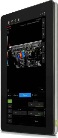 Piloter Ultrasound Scanner - Image 3