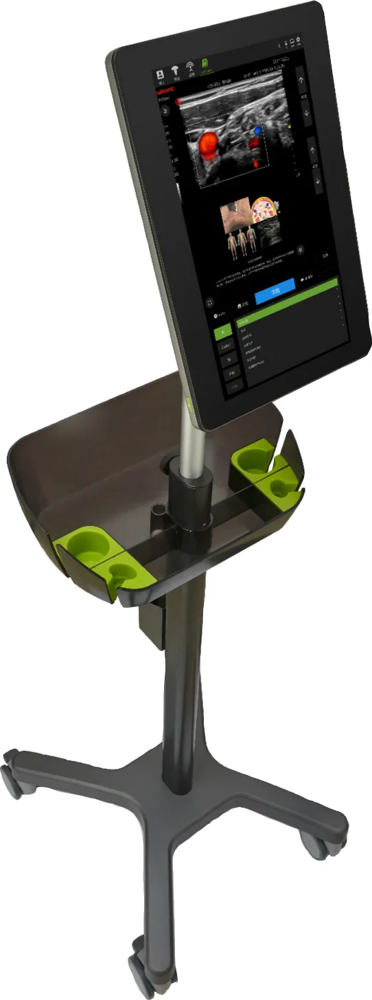 Piloter Ultrasound Scanner - Image 4
