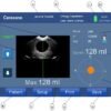 Bladder Scanner HD3 - Image 4