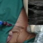 ultrasound guided vascular intervention2.jpg