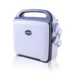 Explore the Benefits of a General Abdominal Ultrasound Scanner