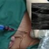 Handheld Ultrasound Scanner - Image 4
