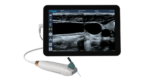point of care ultrasound