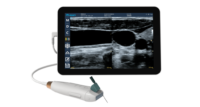 point of care ultrasound