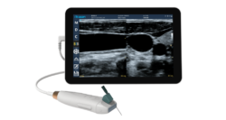 point of care ultrasound
