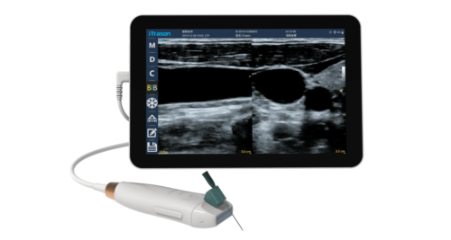point of care ultrasound
