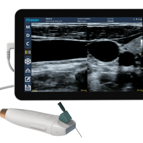 point of care ultrasound