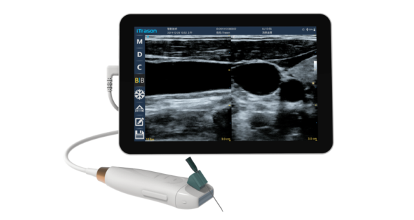 point of care ultrasound
