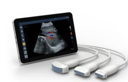 Revolutionizing Medical Imaging: The Power of Handheld Ultrasound Devices Connected to Tablets, PCs, or Mobile Phones