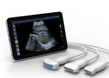 Revolutionizing Medical Imaging: The Power of Handheld Ultrasound Devices Connected to Tablets, PCs, or Mobile Phones