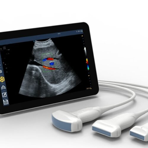 Revolutionizing Medical Imaging: The Power of Handheld Ultrasound Devices Connected to Tablets, PCs, or Mobile Phones