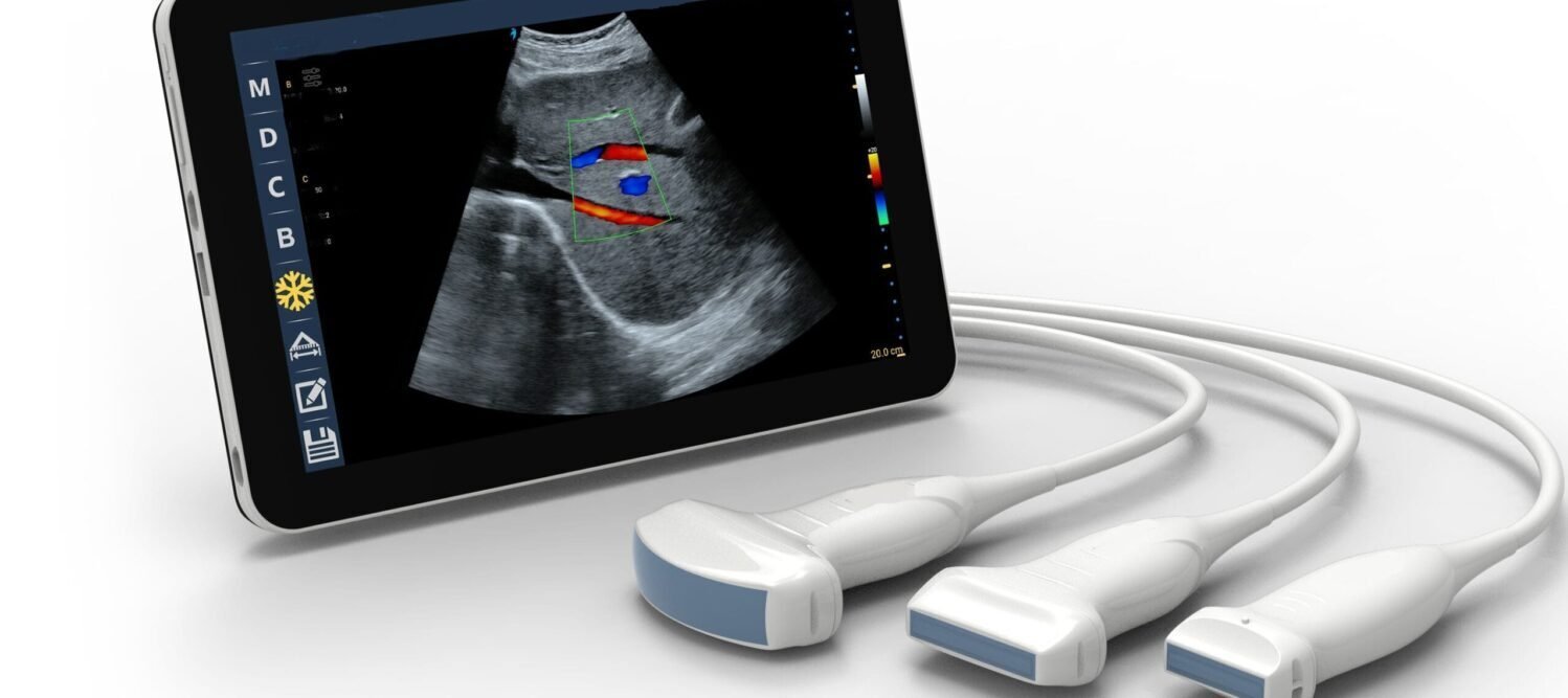 ultrasound scanner usb meditechnik